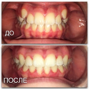 Фото от владельца Здоровые зубки для всей семьи, стоматологическая клиника