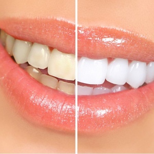 Фото от владельца White & Smile, студия косметического отбеливания зубов