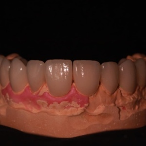 Фото от владельца Actual Stom, стоматология