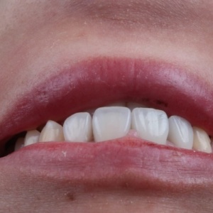 Фото от владельца Actual Stom, стоматология