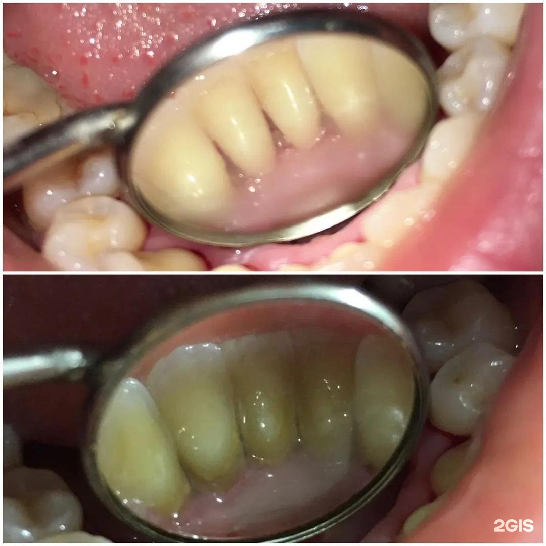 Стоматология Авиценна в Туапсе 🦷 телефон регистратуры, рейтинг, отзывы,  цены | telephone-stomatologii.ru